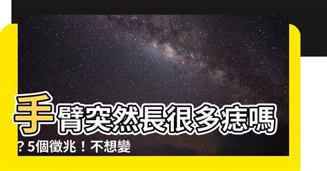 手臂長很多痣|別把癌當痣！5部位冒黑點恐是惡性黑色素瘤 台大醫師。